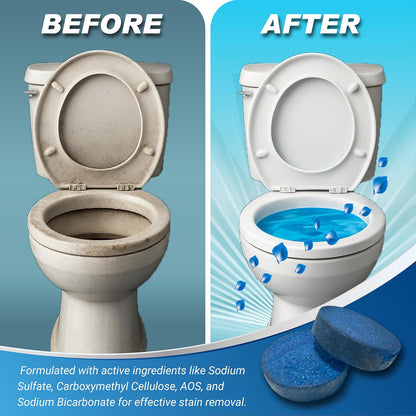 Automatic Toilet Bowl Cleaner Tablets – 20 Tabs - Blue Gel Toilet Tank Cleaners, Hard Water Ring